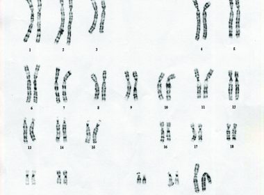 Chromosomes: The ENCODE Project seeks to unravel mysteries of the human genome. (www.mun.ca )
