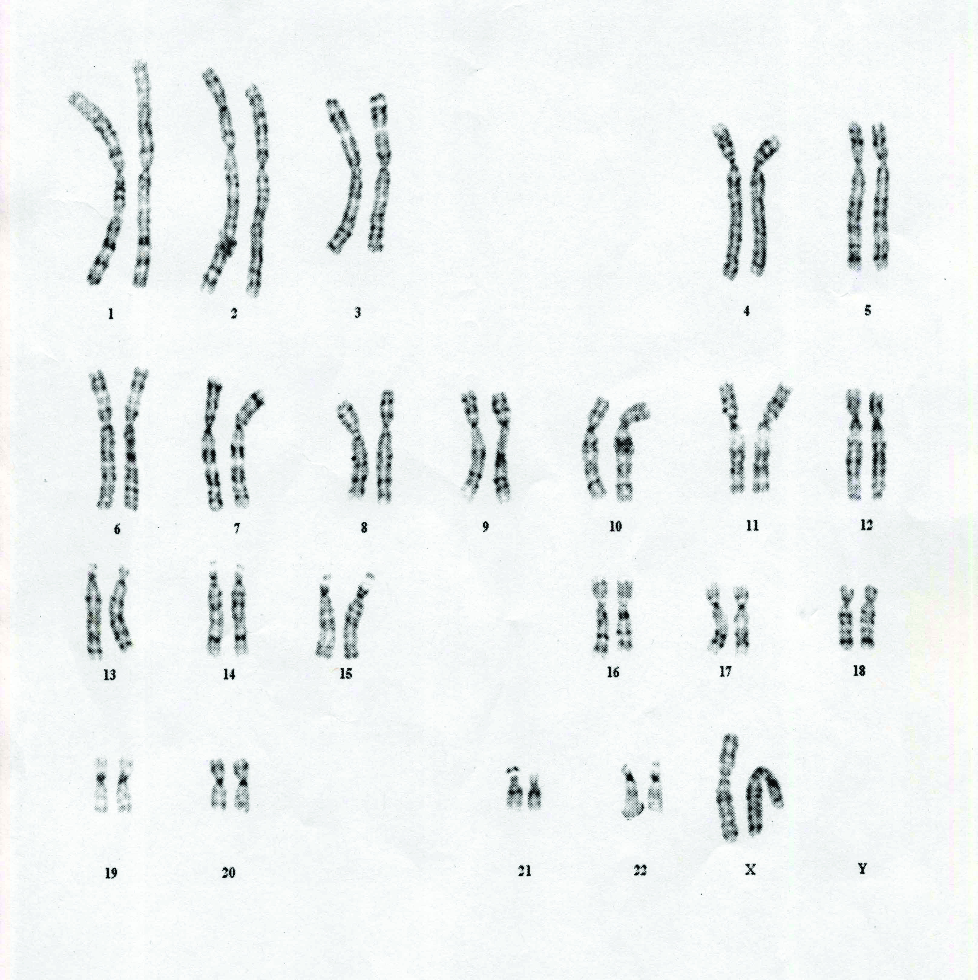 Chromosomes: The ENCODE Project seeks to unravel mysteries of the human genome. (www.mun.ca )