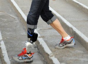 iWalk’s bionic foot and ankle. (astepaheadprosthetics.wordpress.com)
