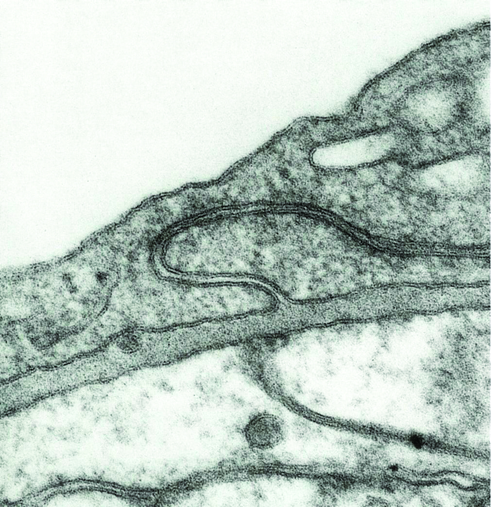 The blood-brain barrier. (http://911stroke.info/)