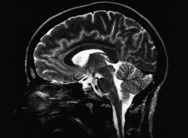 Online brain games may prevent cognitive degeneration. (mindblogs.smartandstrong.com)