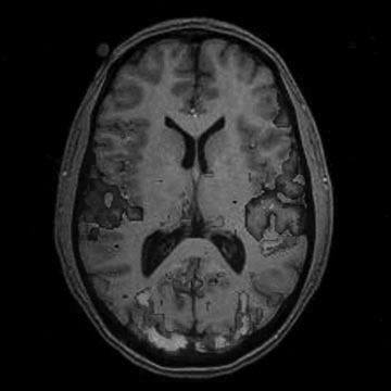 Cornell researchers used fMRIs to observe brain activity. (Image Source: scientopia.org)