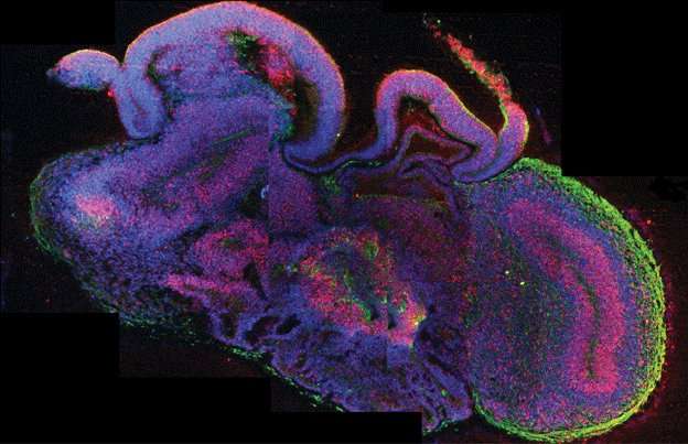 Neural clumps in fetal brains